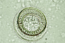 Single celled parasite Trichodina