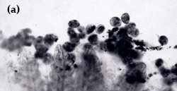 Chilodonella a