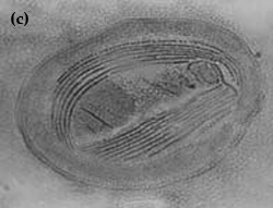 Chilodonella c