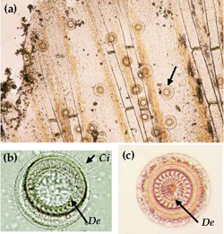 Trichodina