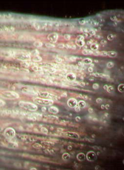 Gas bubble disease