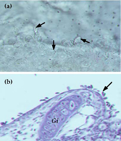 Ichthyobodo