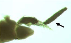 Ergasilus intermedius